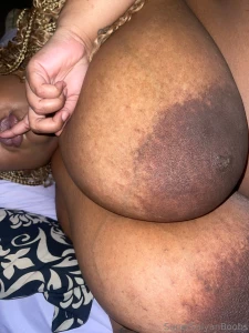 Finally had the energy to get pretty you can see some of my scars but part 8