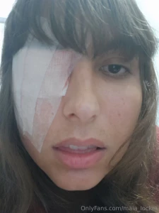 Bruised vulnerable and ready to obey my purple eye and broken hand won part 2