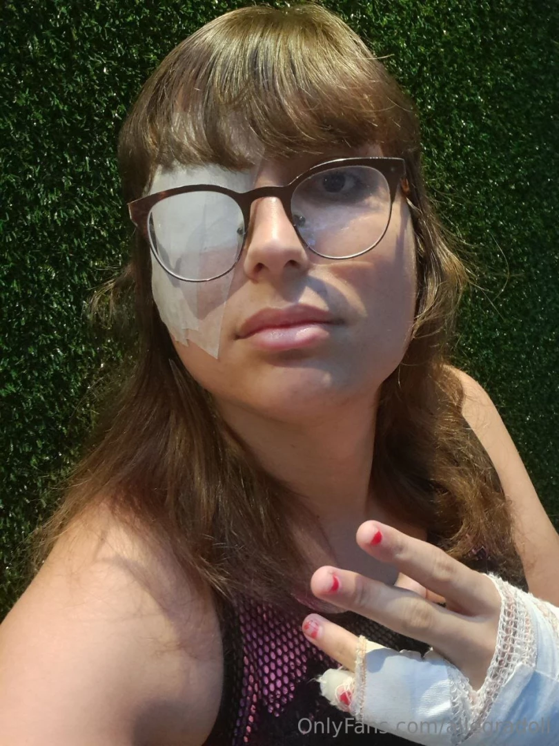 Hey everyone i had eye surgery today and my hand is broken who loves part 1 