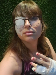 Hey everyone i had eye surgery today and my hand is broken who loves part 1