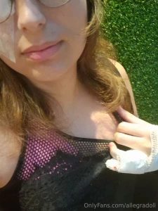 Hey everyone i had eye surgery today and my hand is broken who loves part 4