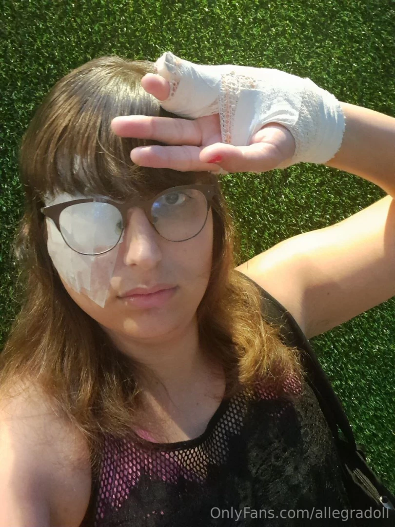 Hey everyone i had eye surgery today and my hand is broken who loves part 2 