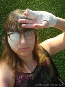 Hey everyone i had eye surgery today and my hand is broken who loves part 2