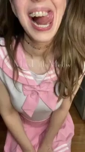 For my braces lovers