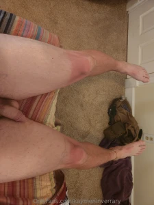 Damn i got burnt part 1