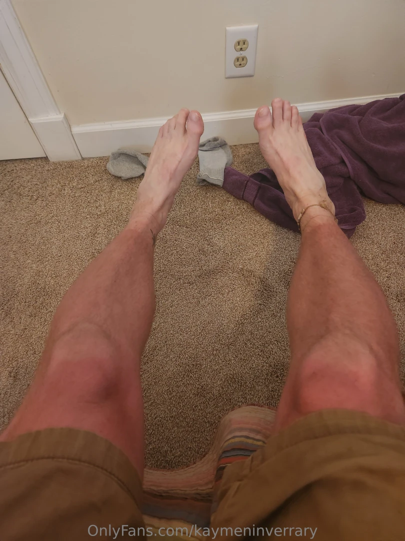 Damn i got burnt 
