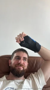 Guess who broke their wrist in two places