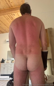 Look at how sunburnt i got