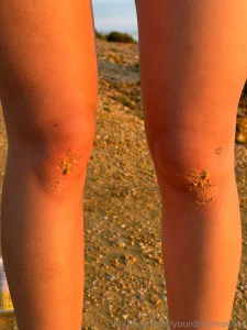 The second photo is what my knees look like after standing on them