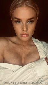 Freckles part 4