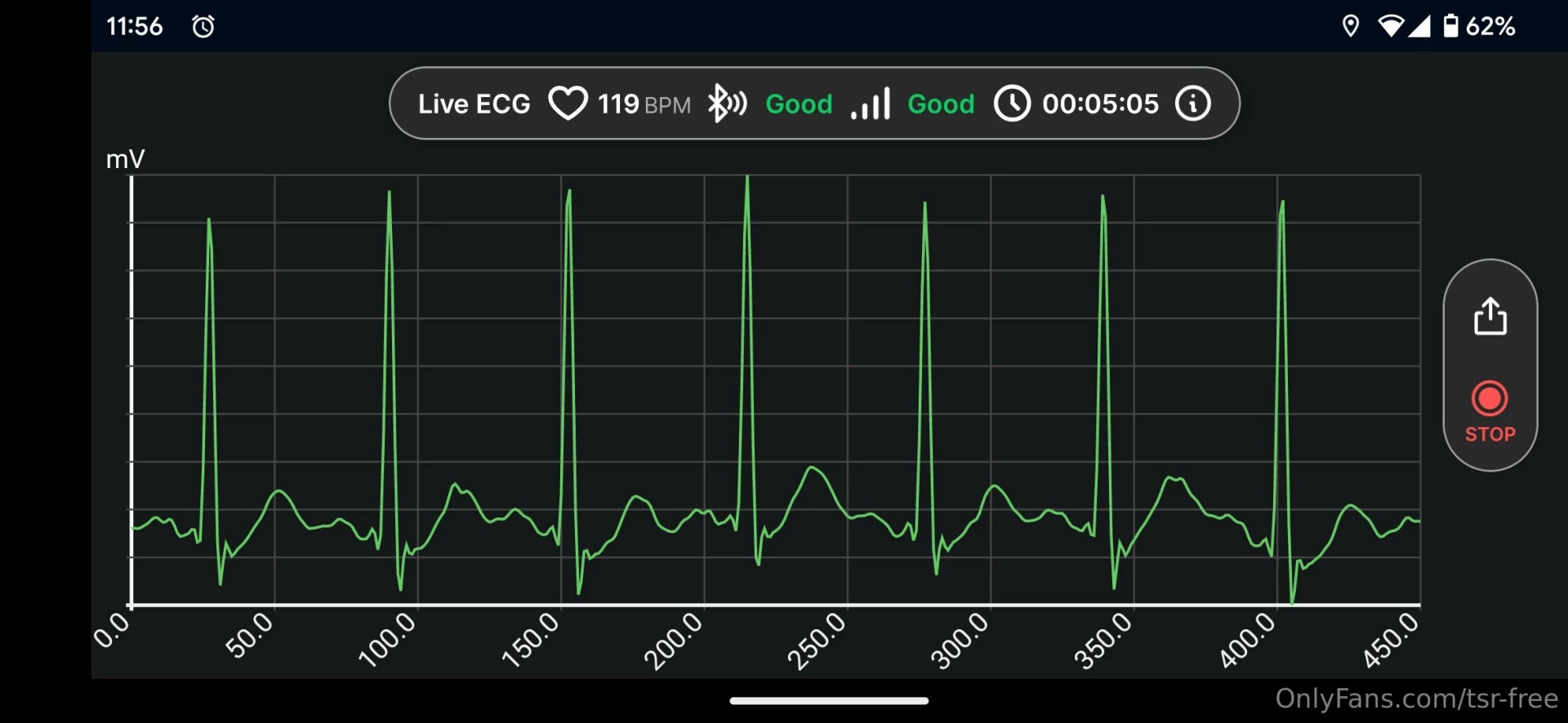 I ve been experiencing a lot of medication-induced tachycardia lately part 1 