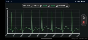 I ve been experiencing a lot of medication-induced tachycardia lately part 1