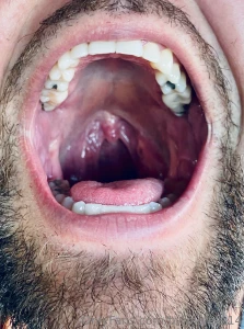 Dive in hit the it s free mouth throat tongue teeth uvula vore