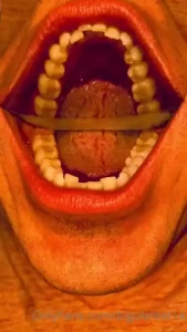 Sneak peak to new video of my partners self teeth exam hit the its