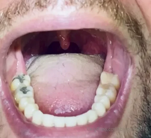 1 minute tour of my lips mouth teeth dental amalgam amp composite 