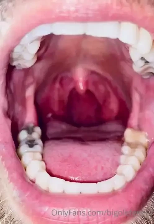 Welcome to my mouth teeth tongue uvula and throat hit the like button 