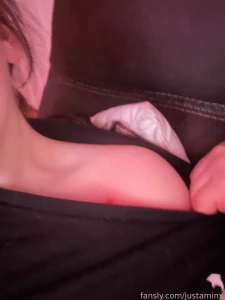 Dislocated my right collar bone the other day can someone koss ot