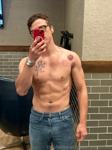 Strength and scars every mark tells a story