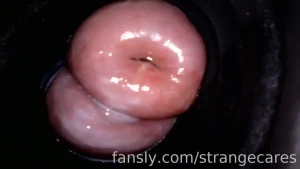 Doesn t my cervix look inviting fyp cervix gyno endoscopy
