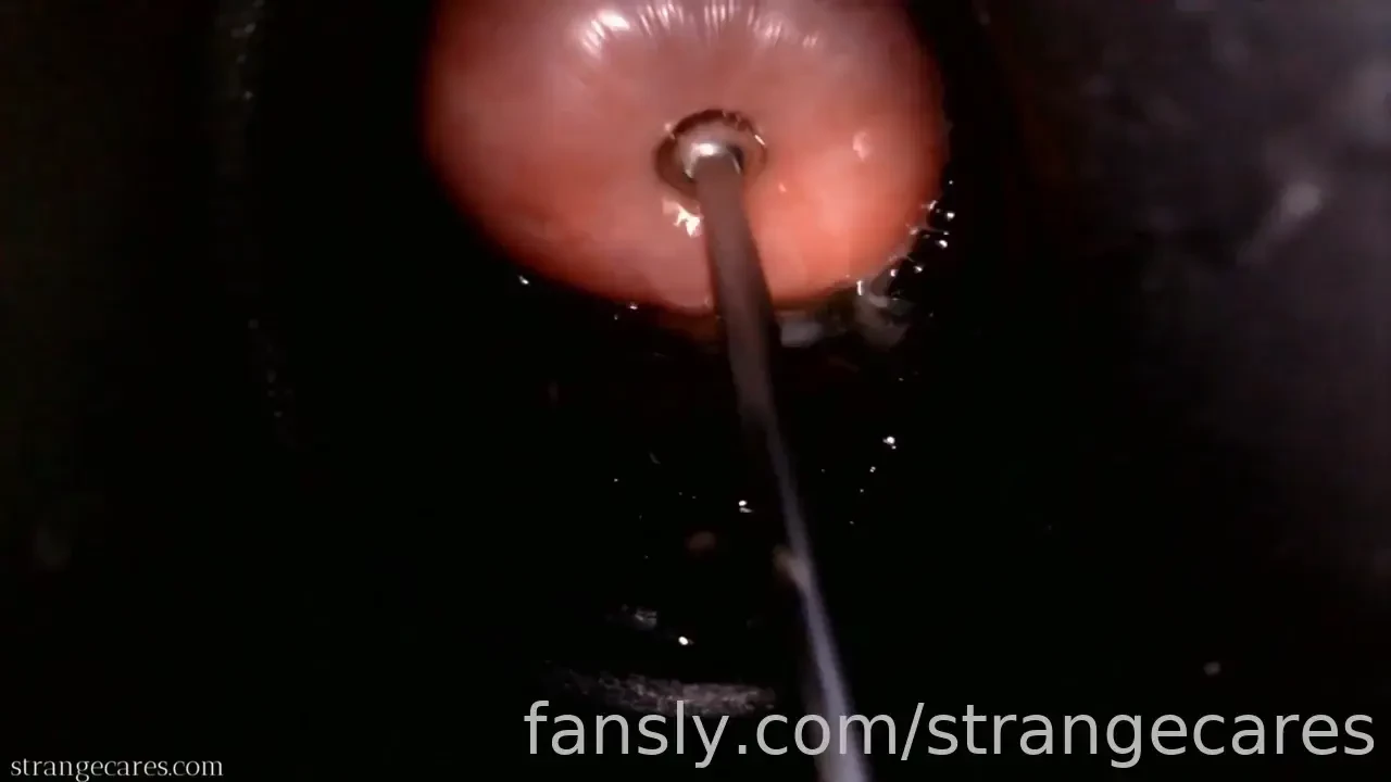 Time for a new video cervix wrinkles as large sounding rod pushes 