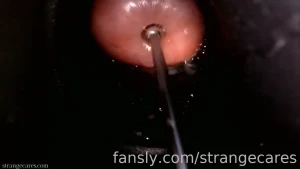 Time for a new video cervix wrinkles as large sounding rod pushes