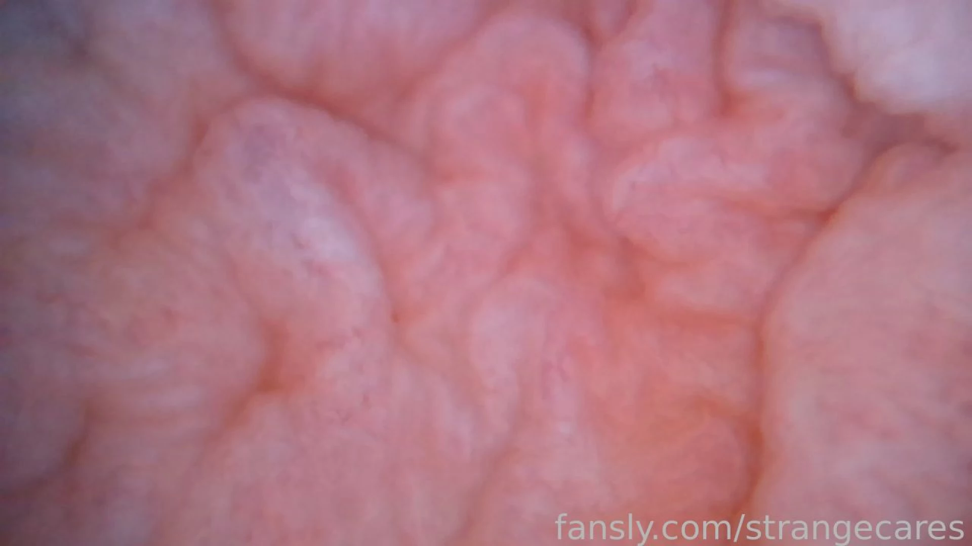 The inside of my bladder looks more and more like a brain as i empty 