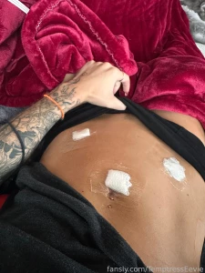 Currently bored recovering from surgery yesterday your girl got a