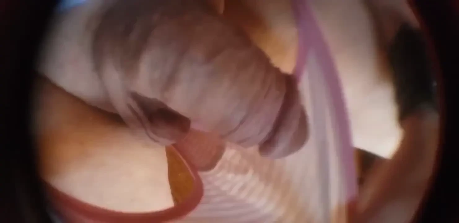 Stuffed in my striped thong - right in the morning a warm embrace from 