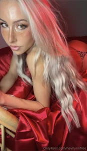 My forehead vein and i are wishing you all a happy friday