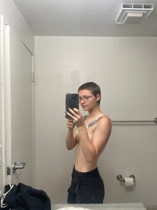 I got burrnnt the other day and here s the aftermath part 2