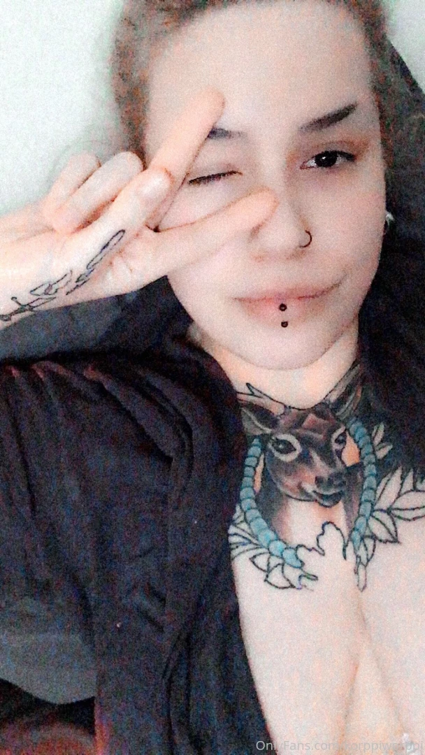 Recovering from surgery gt the actual surgery went well no concerns 