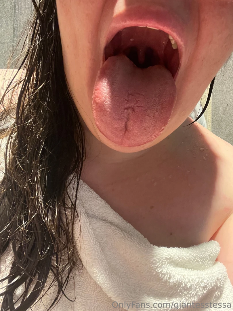 Check your dms part 2585 