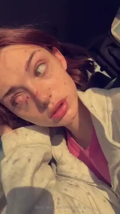 Hi my shroomies i got into a really bad car accident today someone 