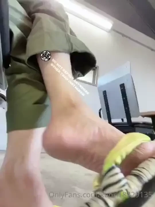 Soles skin s peeling off lol 