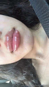 Mommy got another syringe a filler that makes two syringes in my lip