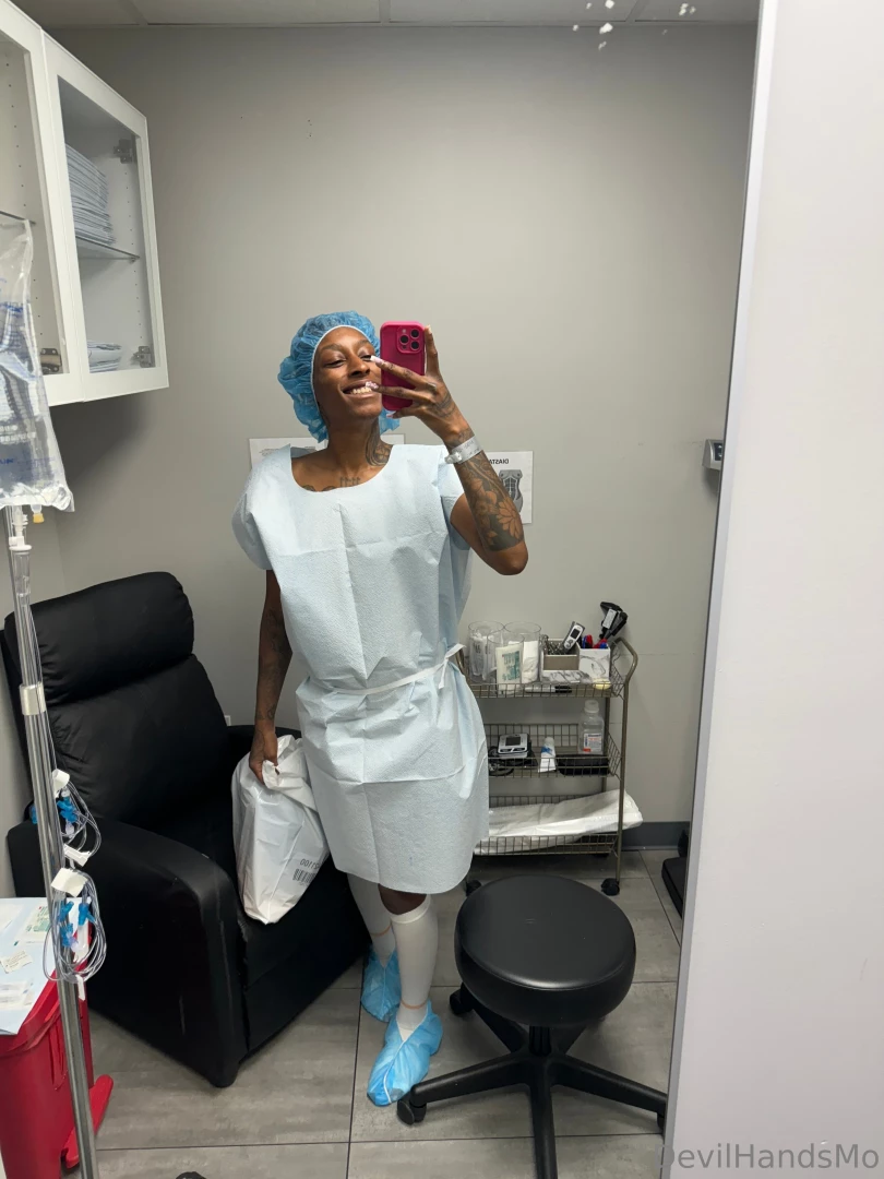 Post opt day 1 surgery was successful amp i am healing the girls are part 1 