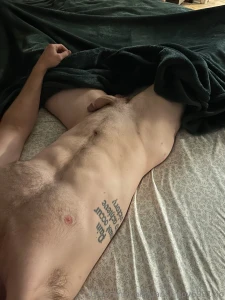 I have so many bug bites all over my body