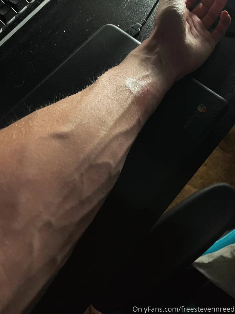 Veins part 9 