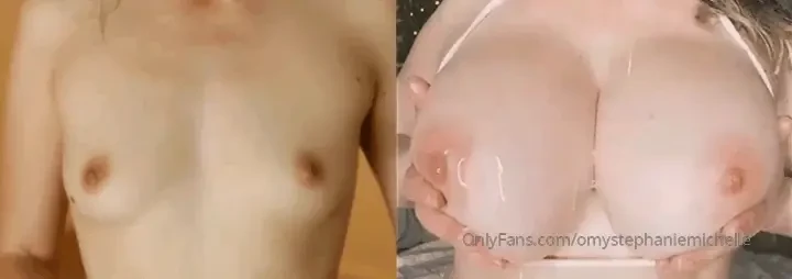 I seriously can t believe how much silicone the surgeon was able to 