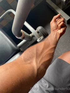 If i have veins here i have them everywhere in my body can you guess