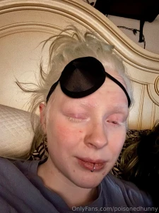 Spent my christmas night at the e r i ll be taking a tiny break from