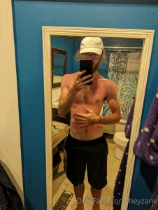 Sorry for covering up the abdomen but i had to show how burnt i got