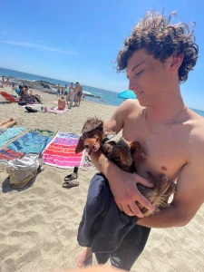 Beach before surgery honestly life is ok but it s great once you