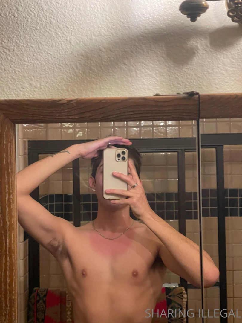 Went skiing and got terribly sun burnt for wearing a tank top ooops 