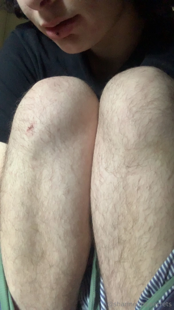 Scraped my knee guess how 