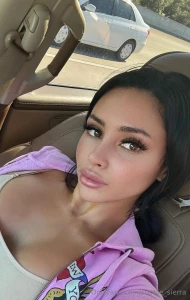 Guess what i had done first glimpse of my new boobs