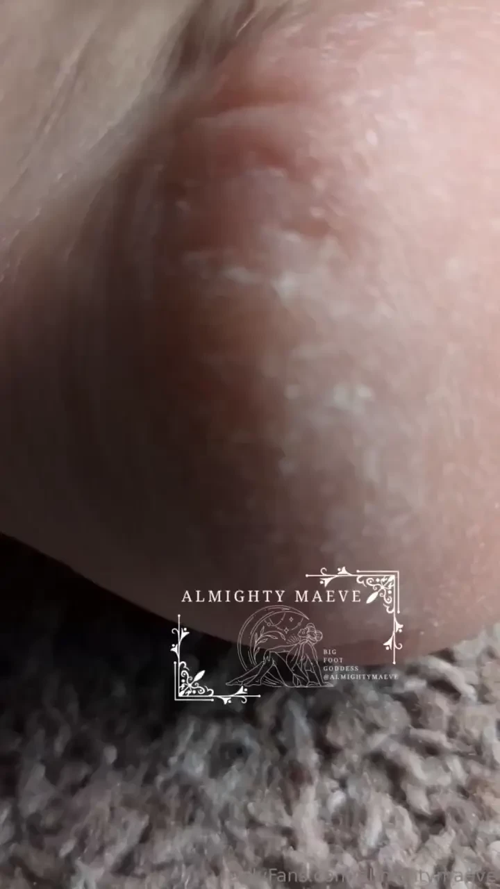 Up close dry heels and soles they are so dry come rub foot cream on 