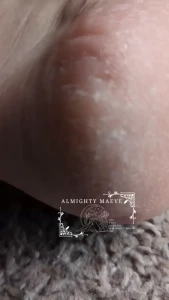 Up close dry heels and soles they are so dry come rub foot cream on