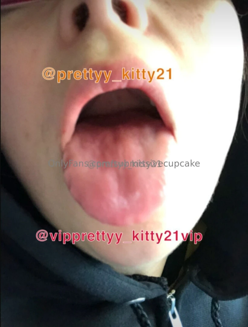 Congratulations nbsp prettyy_kitty21 you won open wide thank you for 