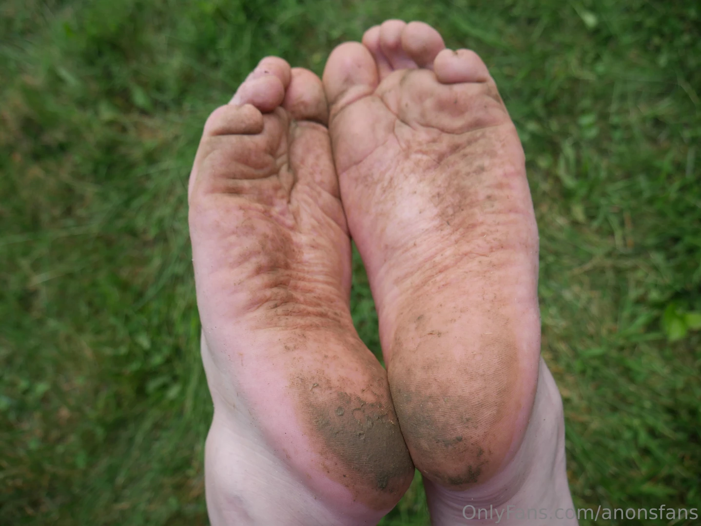 My feet before and after walking barefoot outside first time getting 